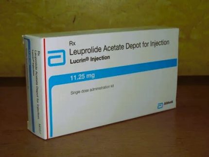 Lucrin Depot3